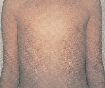 mycoplasma.jpg